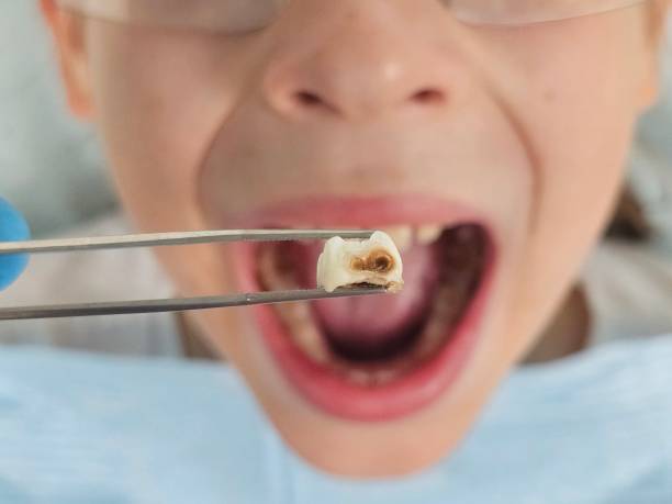 Best Pediatric Emergency Dentist in Brundidge, AL